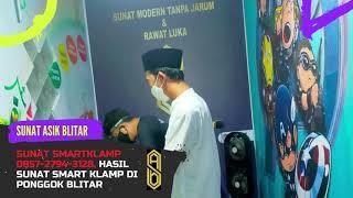 SUNAT SMARTKLAMP 0857 2794 3128, hasil sunat smart klamp di Ponggok Blitar