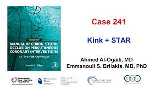 Case 241: Manual of CTO PCI - Kink + STAR