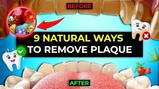 9 Natural Ways To Remove Plaque & Tartar Buildup In Teeth