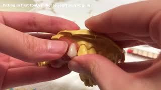 Make the PERFECT Denture Do-It-Yourself Dentist Quality DIY Best Dentures