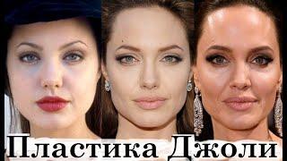 Неидеальная Анджелина Джоли - Пластика и косметология (2021)