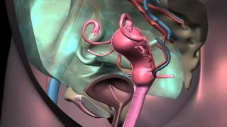 Uterus Transplant Animation DONOR