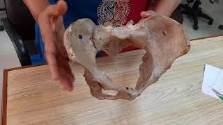 Anatomical position of Pelvis| 1st year MBBS Students| Dr. Meenakshi Modi Bansal