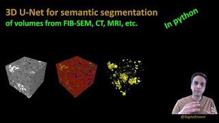 215 - 3D U-Net for semantic segmentation