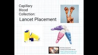 Capillary Blood Collection: Lancet Placement for Finger Poke