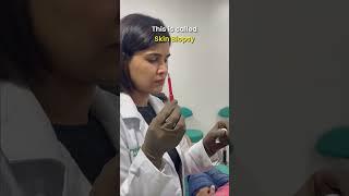 Skin Biopsy ‍️ Procedure By Dermatologist || Dr. Priyanka Reddy || DNA Skin Clinic || #shorts