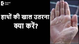 हाथों की खाल उतरना | Skin Peeling के लिए क्या करें? - डॉ. रसया दीक्षित