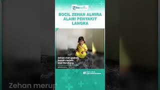 Bocil Zehan Almira Alami Penyakit Langka Osteogenesis Imperfecta