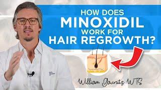 Minoxidil: How Does Minoxidil Work For Hair Regrowth Results? - Trichologist William Gaunitz