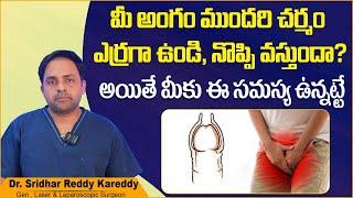 Permanent Solution for Phimosis in Telugu || Best Solution for Tight Foreskin in Telugu || TRH