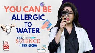 Can You Get Allergic to Water? ll What Is The Science Behind Aquagenic Urticaria?