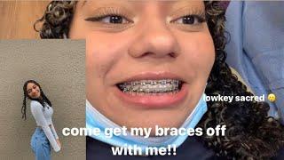 come get my braces off with me!! | Sierra Nichole