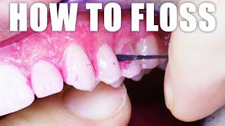 Dentist Shows HOW TO FLOSS YOUR TEETH PROPERLY: Correct Dental Flossing Technique! Tutorial Back