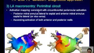 AT after AF Ablation : Usual Suspects