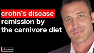  What Is It About the Carnivore Diet and Crohn's Disease That Leaves Doctors Speechless? Watch This