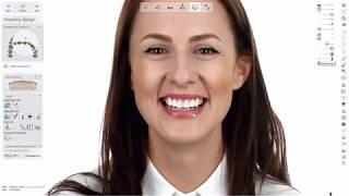 3Shape Dental System - Smile Design With RealView Engine Design