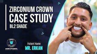 Zirconia Crown Case Study (BL2 Shade) - Narrated by Dr. Omer Karaaslan