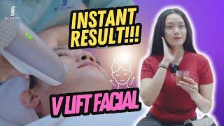 Qamarinalim’s VLIFT Facial Experience at RJ CLINIC | Full Process & Amazing Review