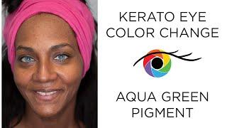 Eye Color Change from Dark Brown to Aqua Green with Kerato