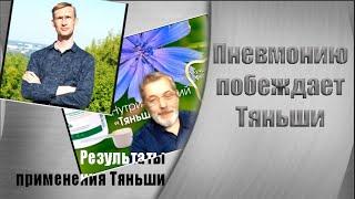 Пневмония у парня из села и Тяньши// Результаты применения Тяньши