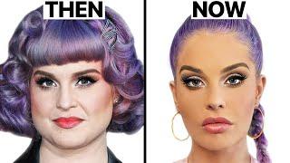 Kelly Osbourne Plastic Surgery - Surgeon Reacts