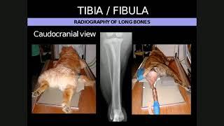 Lecture 1 MSK appendicular and fracture into