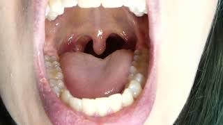 Am I Sick? Sore Throat Mouth Tour #teeth #tongue #tonsils