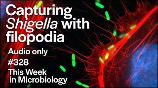 TWiM 328: Capturing Shigella with filopodia