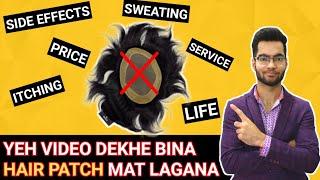 Yeh video dekhe bina hair patch mat lagana| Full info about hair patch