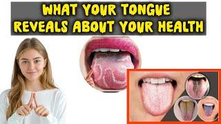 What your Tongue Reveals about your Health: A Guide to Colors and Clues