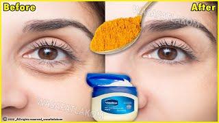 In just 3 days it removes wrinkles and bags under the eyes completely, Dark Circle, Puffy Eyes