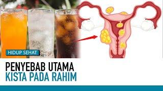 Penyebab Kista pada Wanita | Deteksi Penyakit