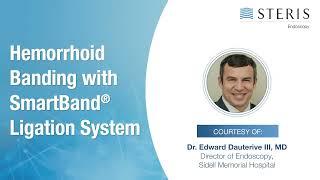 Hemorrhoid Banding Using the SMARTBAND™ Multi-Band Ligation System | STERIS