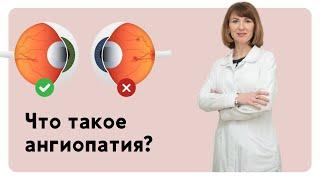 Что такое ангиопатия сетчатки глаза?