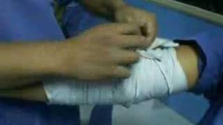 bandaging an elbow (straight)