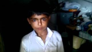 cat eye boy in pakistan