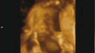 3D/4D УЗИ 28 недель (3D/4D Ultrasound scan baby 28 Weeks)