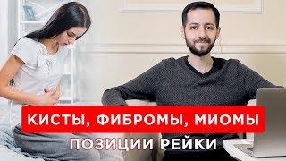 КИСТЫ, ФИБРОМЫ, МИОМЫ. Позиции Рейки