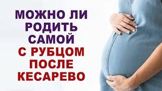 Если есть рубец от кесарево, значит только кесарево? Можно ли родить самой с рубцом от кесарево?