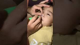 BOCIL KEMASUKAN KELERENG DALAM HIDUNG#shorts #videoshort