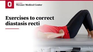 Exercises to correct diastasis recti | Ohio State Medical Center