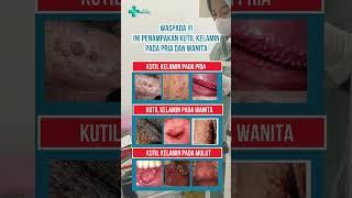 Penampakan Penyakit Kutil Kelamin Pada Pria dan Wanita #kutilkelamin #hpv #hpvictus16 #hpviral