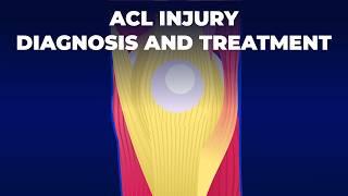 How Does ACL Injury Happens and What can You Do