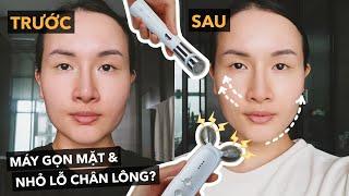 Thử máy làm thon mặt trong 2 tuần và đây là kết quả