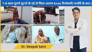 7-8 साल पुराने घुटनो के दर्द से मिला आराम knee रिप्लेसमेंट सर्जरी के बाद |