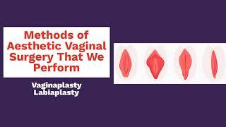 Aesthetic Vaginal Surgery