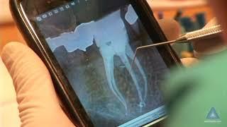 Critical Case Review - Learn & Let Go: Advanced Endodontics