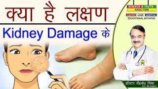 क्या है लक्षण Kidney Damage के ||TOXIC KIDNEY COMMON SIGNS THAT  YOUR KIDNEY IS NOT WORKING PROPERLY