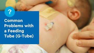 Common Problems with a Feeding Tube (G-Tube)