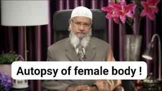 Does ISLAM allows autopsy of female body ? Dr Zakir Naik